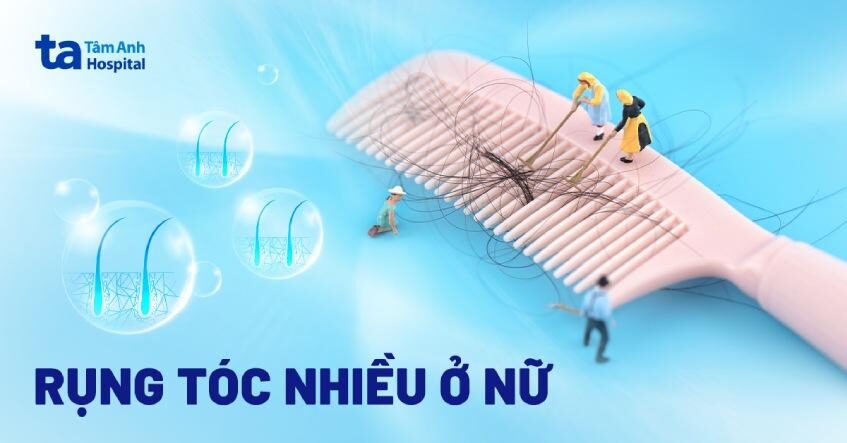 giai-dap-nhung-cau-hoi-ve-rung-toc-o-nu-gioi