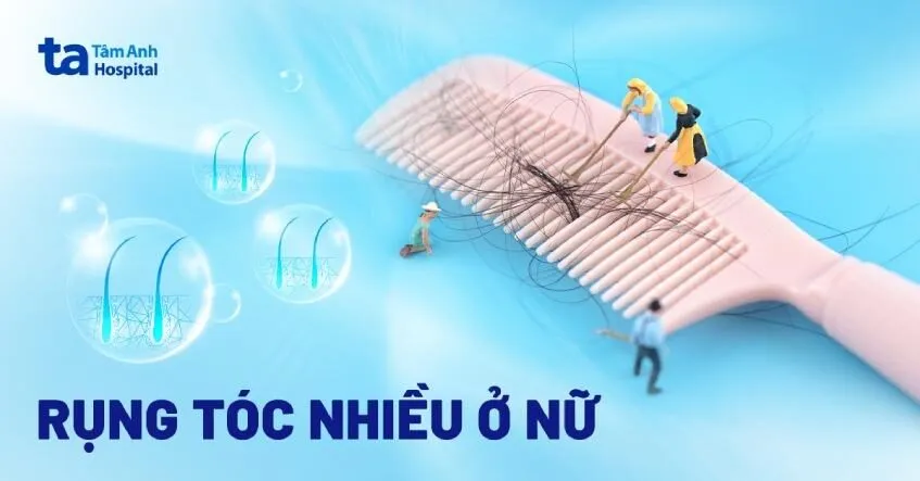 nguyen-nhan-gay-rung-toc-o-nu-gioi