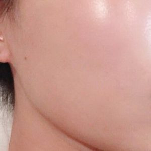 Acid succinic và những lưu ý khi sử dụng