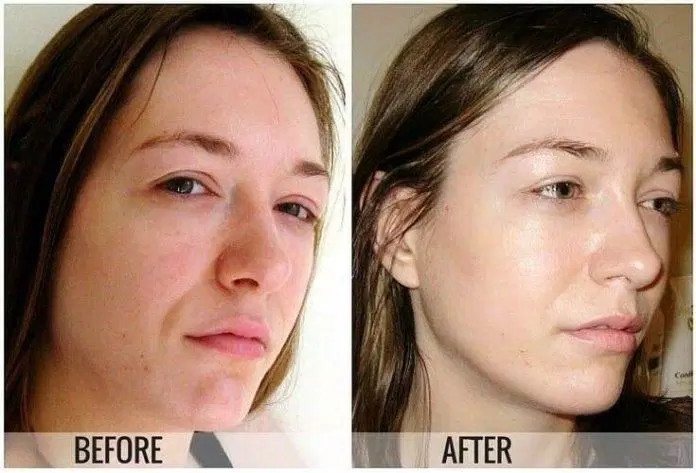 Cảm nhận hiệu quả từ Serum Skinceuticals Vitamin C E Ferulic