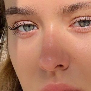 Công dụng của Retinol