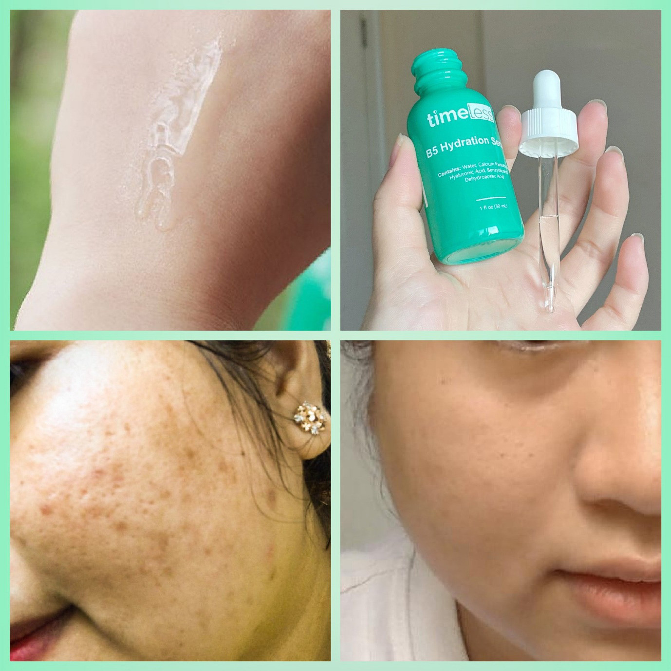 Đánh giá hiệu quả serum Timeless Vitamin B5 trước và sau khi sử dụng