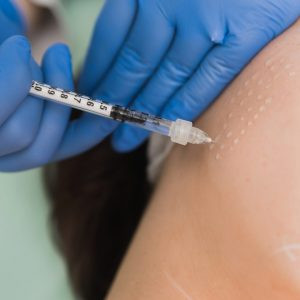 Mesotherapy chiếm ưu thế