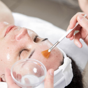 Sự khác biệt giữa Home Peel và Chemical Peel tại Spa