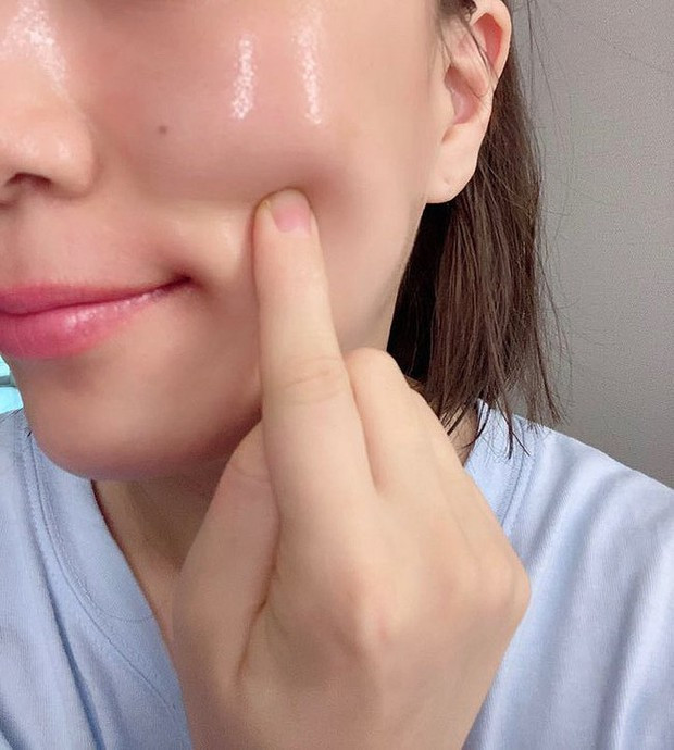 Tác dụng phụ của tiêm meso