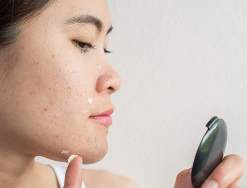 Da phản ứng với sản phẩm