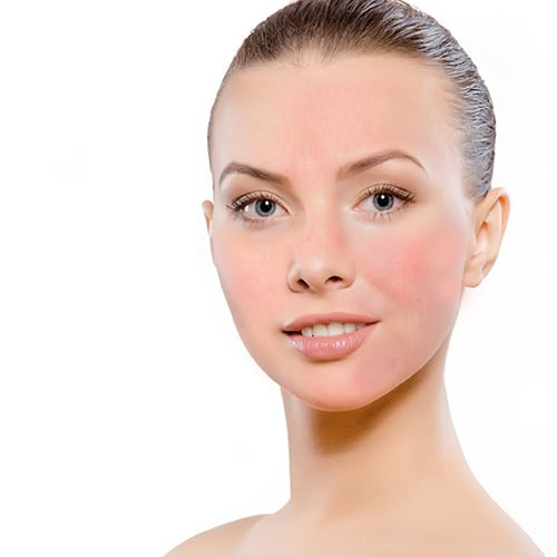 Đặc điểm da nhạy cảm