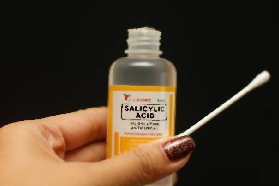 Điều Trị Mụn Cóc Bằng Axit Salicylic