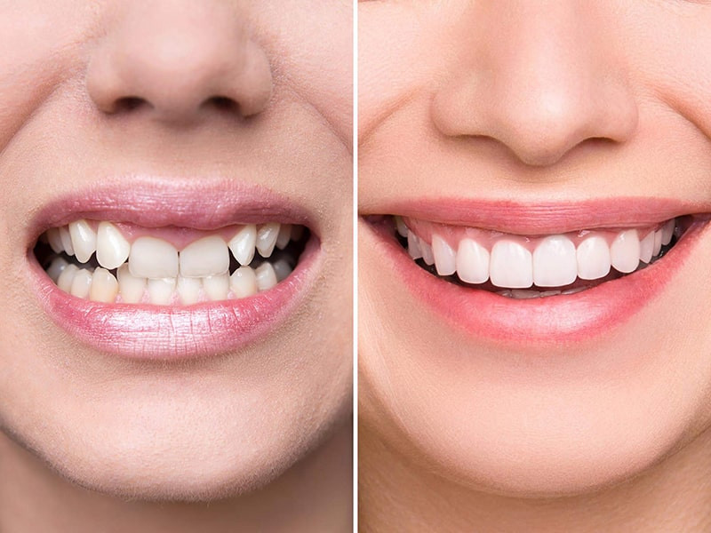 Nha Khoa Tâm Đức Smile