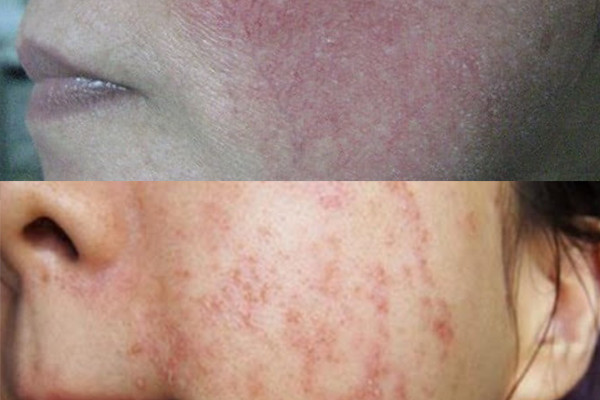 Những tác hại kem trộn gây ra