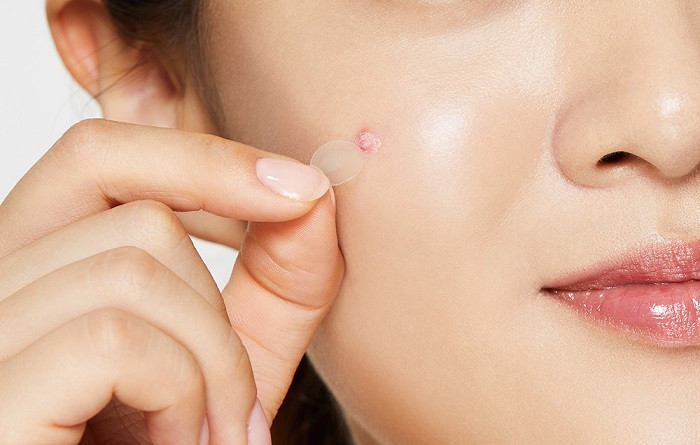 Sử dụng miếng dán mụn để che vết thương hở hoặc nốt mụn bị viêm