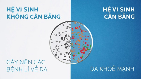 Vi khuẩn gây mụn trên da