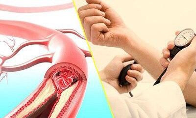 Vitamin C giảm nguy cơ mắc bệnh huyết áp