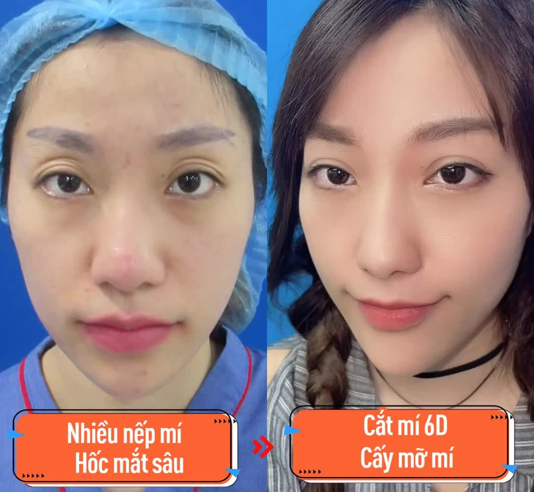Xuân Hương