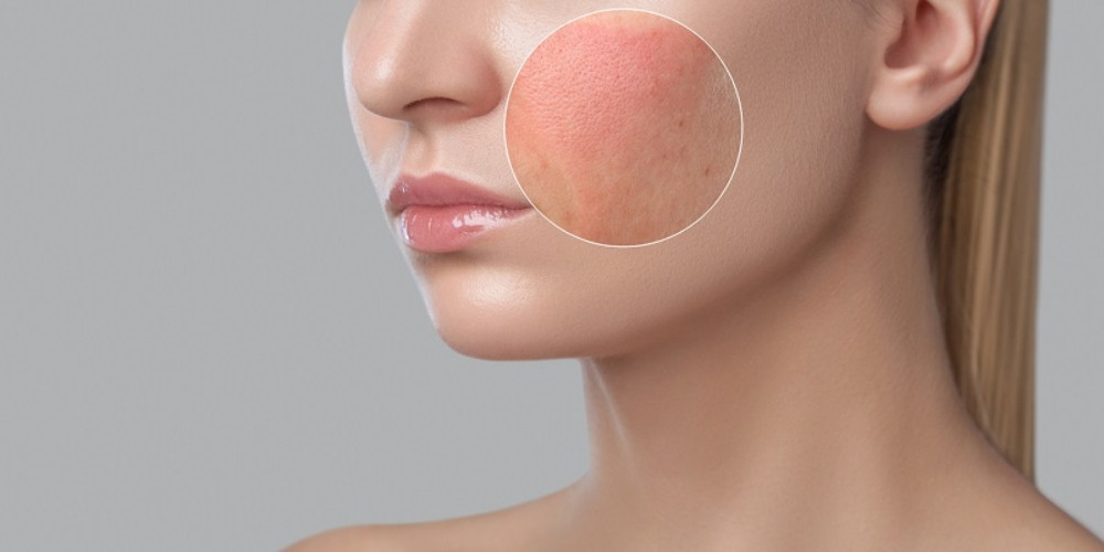 10+ Cách Chăm Sóc Da Không Cần Mỹ Phẩm: Làn Da Khỏe Mạnh Từ Thiên Nhiên