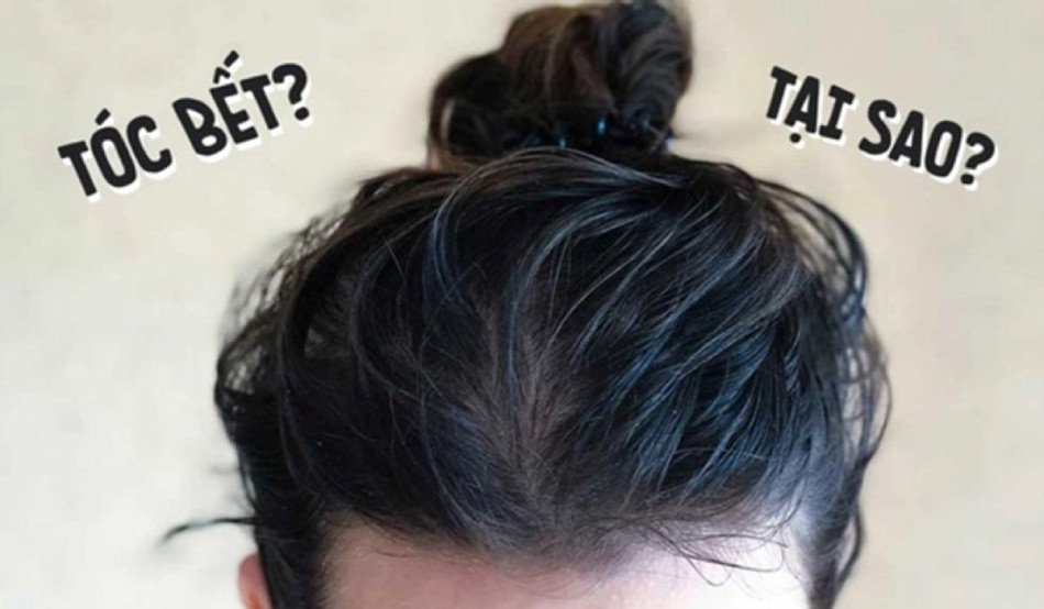 10 Cách Trị Dứt Điểm Tóc Bết Hiệu Quả Cho Mái Tóc Khỏe Đẹp