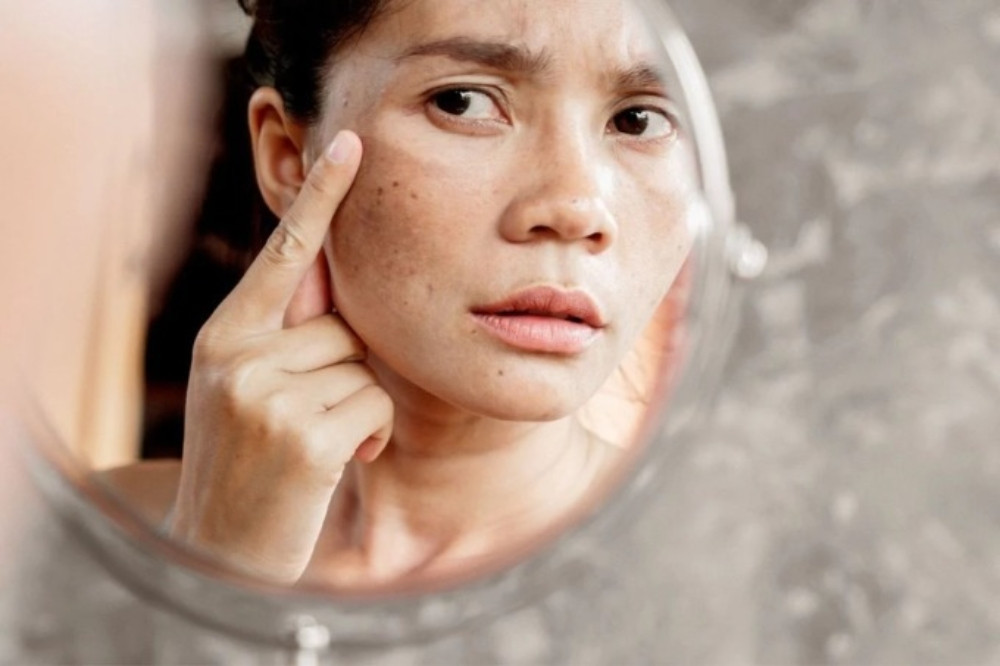 10 Nguyên Nhân Khiến Kem Chống Nắng Bị Vón Cục