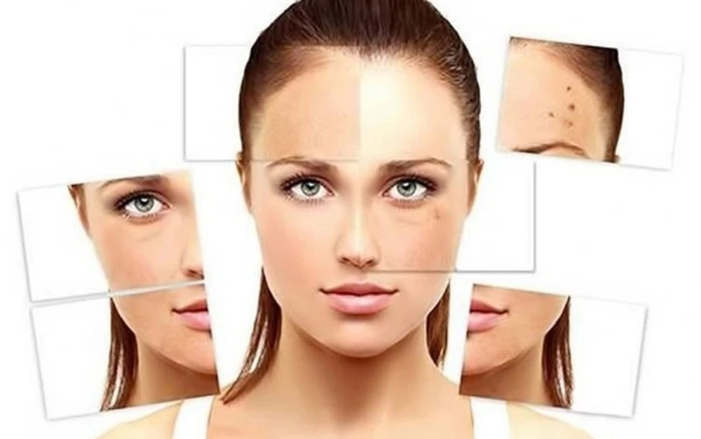 11 Cách Chăm Sóc Da Mặt Trong Mùa Hè Để Luôn Khỏe Mạnh
