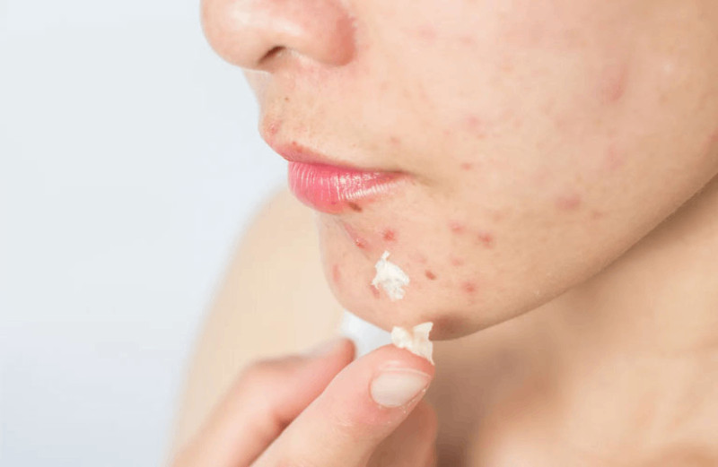12 Bước Chăm Sóc Da Chuyên Sâu Hiệu Quả
