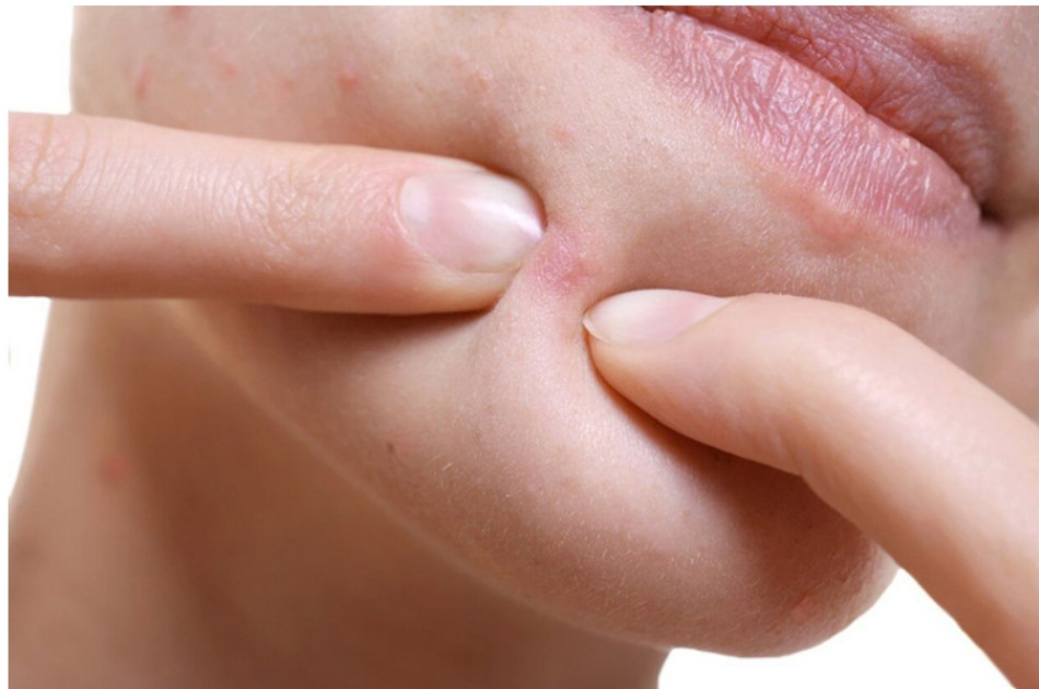 12 Cách Làm Sạch Da Mặt Nhờn Hiệu Quả Cấp Tốc