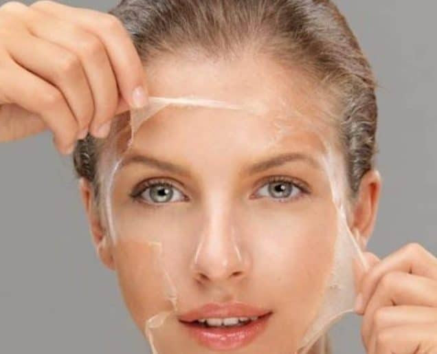 12 cách loại bỏ mụn đầu đen hiệu quả
