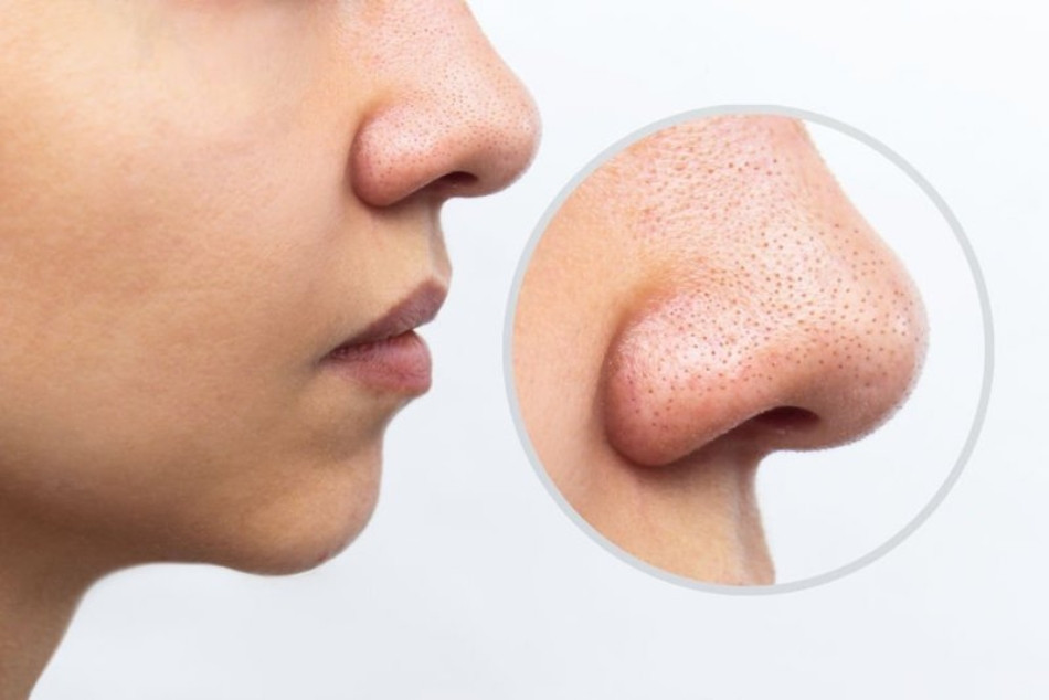 13 Cách Làm Sạch Sỏi Bã Nhờn Ở Mũi Hiệu Quả