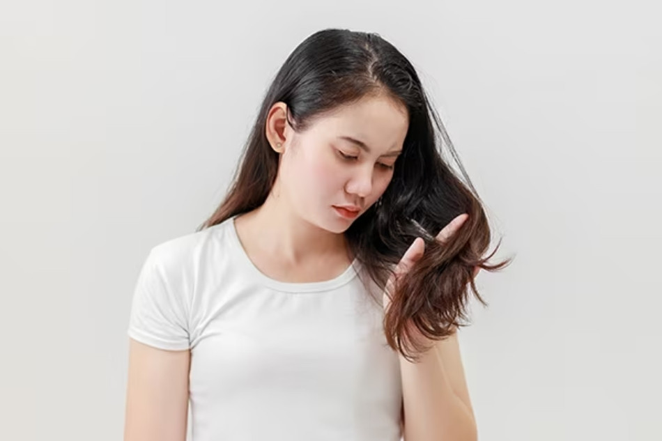 13+ Dầu Gội Dưỡng Ẩm Da Đầu Tốt Nhất 2024