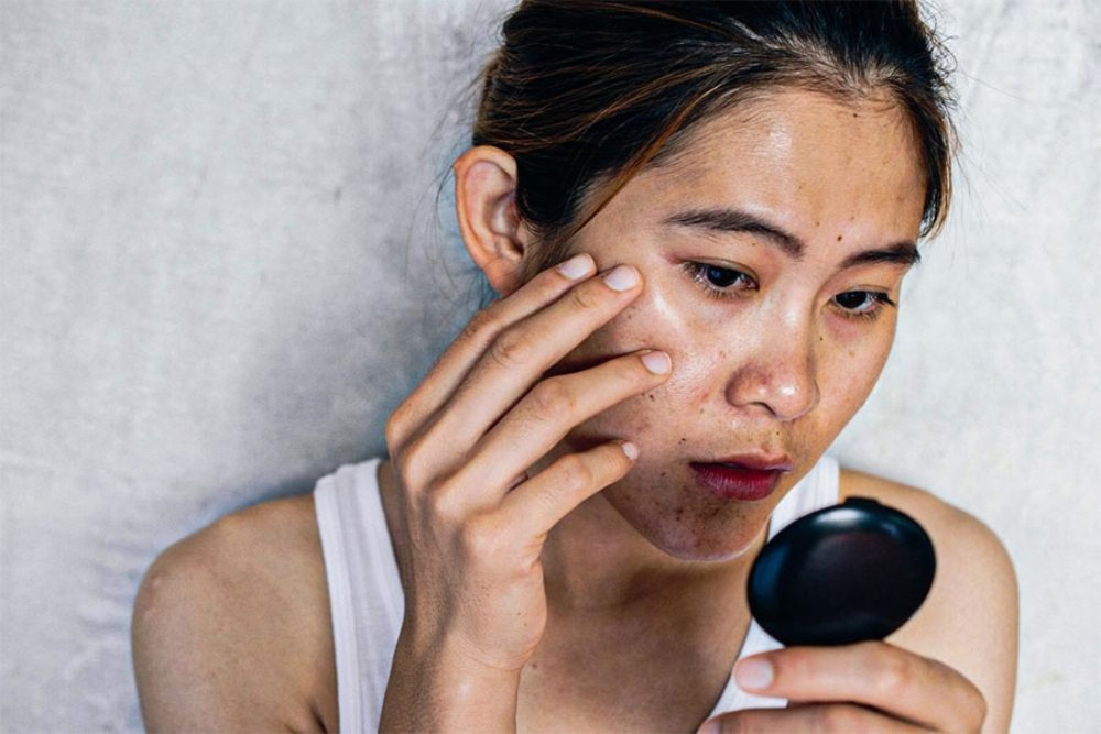 15 Cách Chăm Sóc Da Bị Cháy Nắng Hiệu Quả