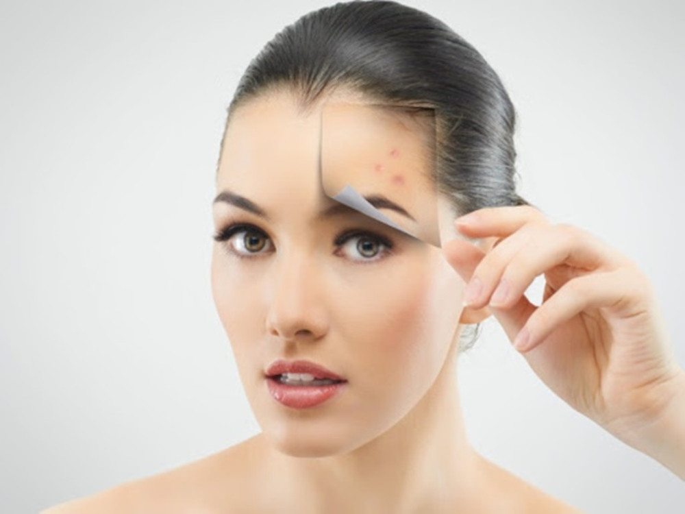 15+ Cách Làm Trắng Da Ở Tuổi Dậy Thì Tự Nhiên Hiệu Quả