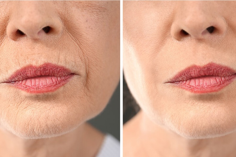 17+ Cách Giữ Da Khỏe Mạnh, Không Bị Lão Hóa Sớm