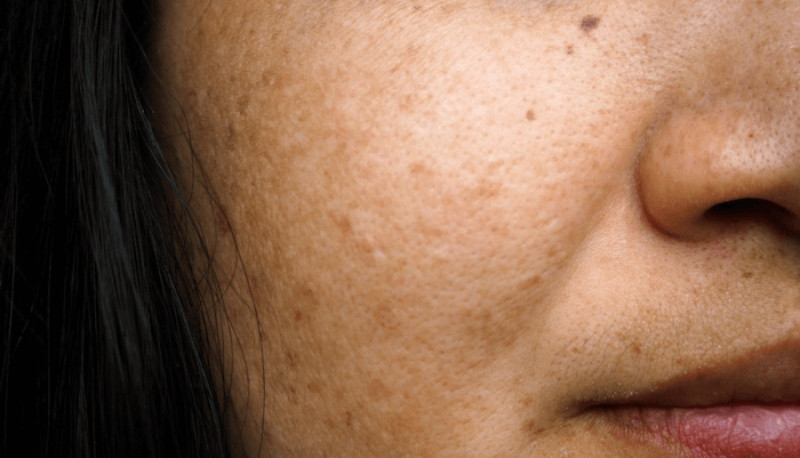 17+ Cách Giữ Da Khỏe Mạnh, Không Bị Lão Hóa Sớm