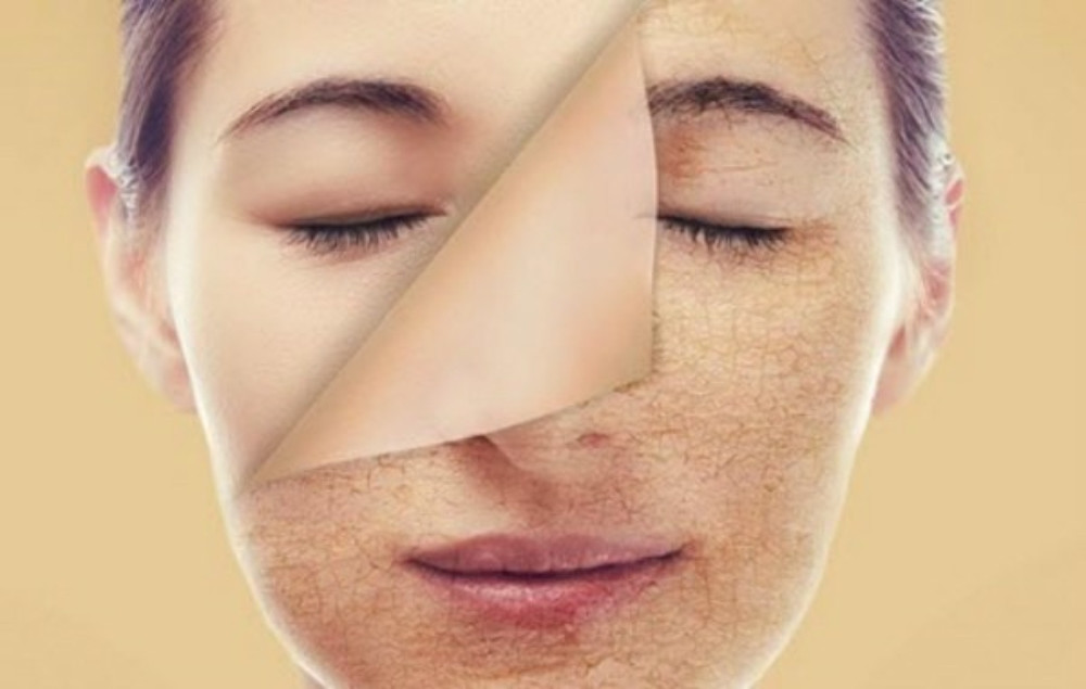 17+ Cách Làm Trắng Da Mặt Bị Sạm Đen Từ Thiên Nhiên Đơn Giản