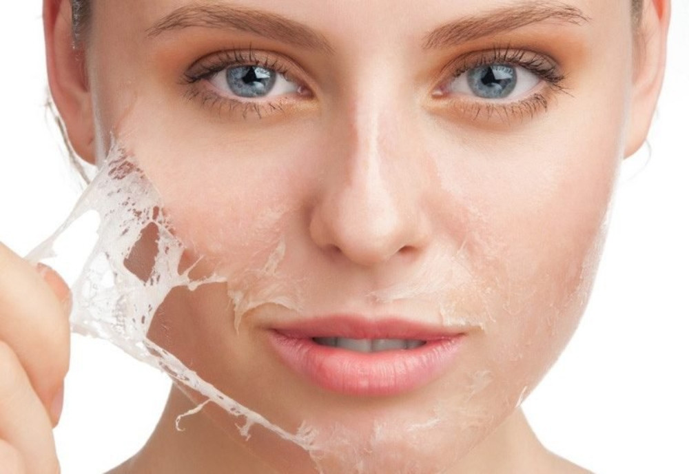 17+ Cách Làm Trắng Da Mặt Bị Sạm Đen Từ Thiên Nhiên Đơn Giản