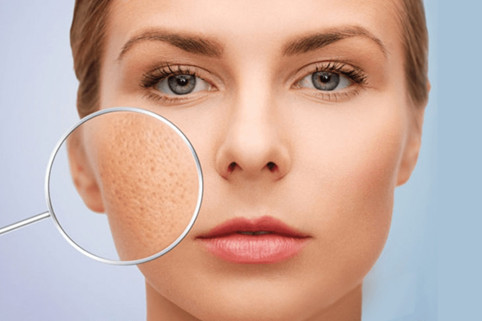 6 Loại Sữa Rửa Mặt Không Nên Dùng Để Bảo Vệ Làn Da Khỏe Mạnh