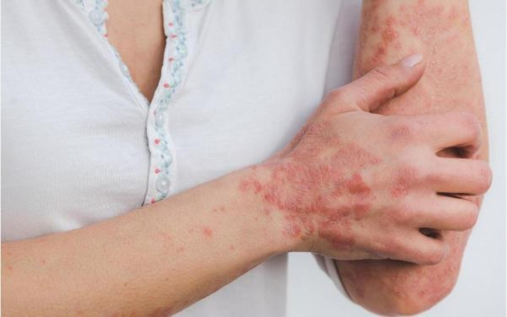 7 tác dụng của Vitamin E với da mặt tuyệt vời mà bạn cần biết