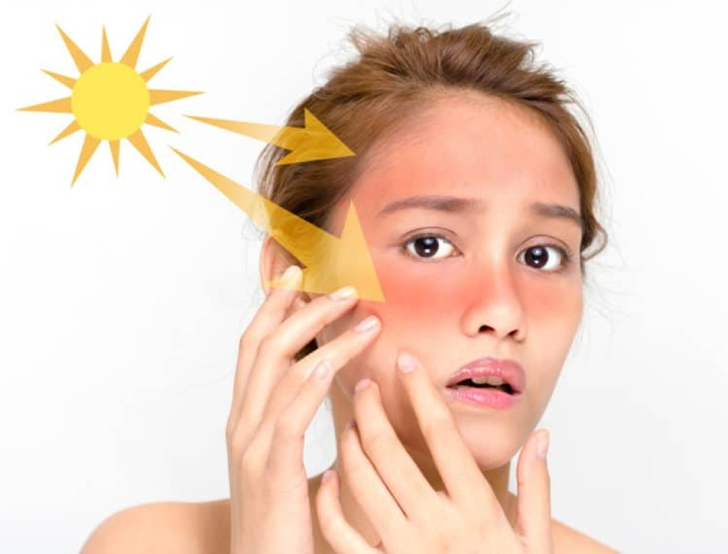 8 bước chăm sóc da khô hiệu quả