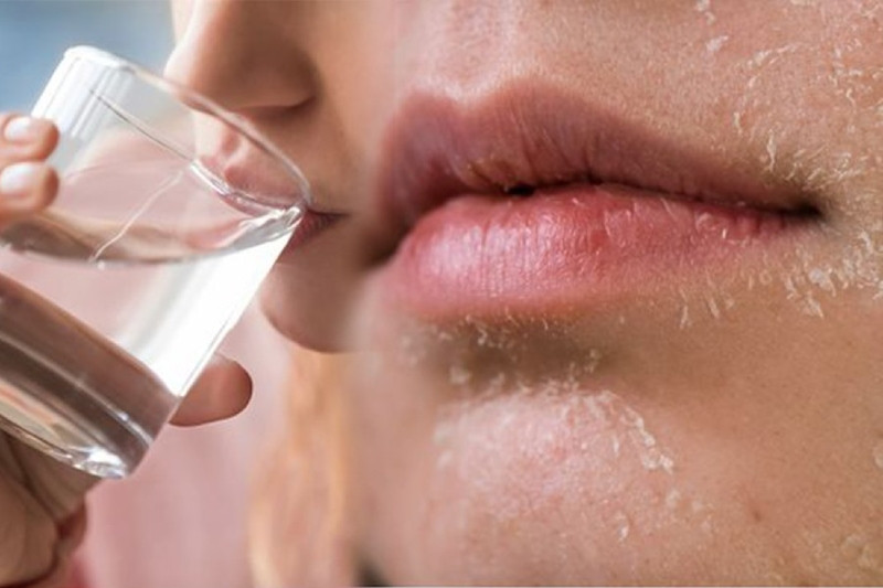 8 bước chăm sóc da khô hiệu quả