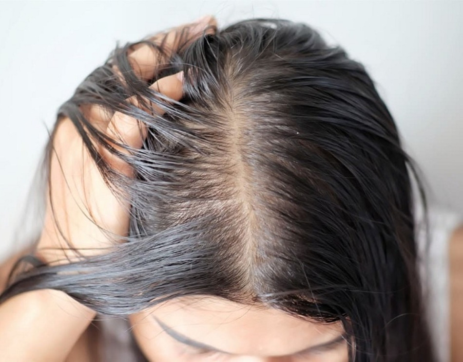 9 Cách Làm Tóc Hết Bết Dính Nhanh Chóng Không Cần Gội Đầu