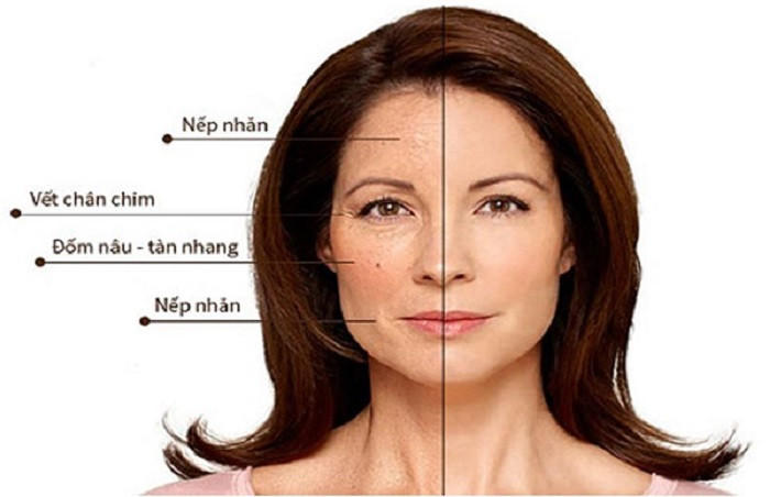 Ảnh Hưởng Của Hormone Đến Làn Da Ở Từng Độ Tuổi