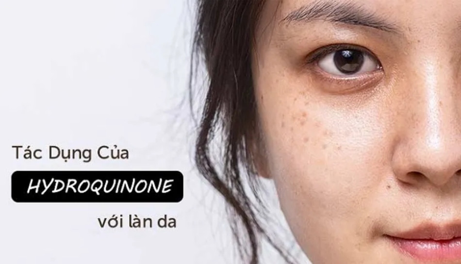 Bà bầu có dùng kem dưỡng da được không? 5 Lưu ý CẦN BIẾT