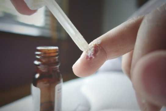 BHA Là Gì? Tìm Hiểu Về Salicylic Acid Trong Chăm Sóc Da