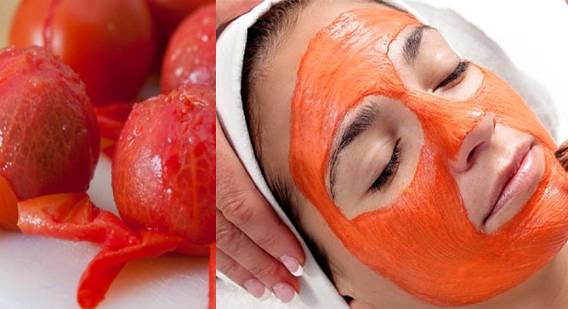 Cách Chăm Sóc Da Mặt Nhờn Đúng Cách Giúp Ngăn Ngừa Mụn Hiệu Quả