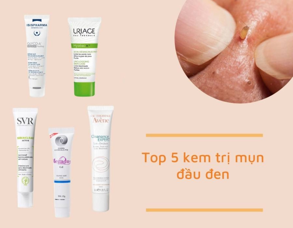 Cách Chăm Sóc Da Mụn Đầu Đen Hiệu Quả và Đơn Giản
