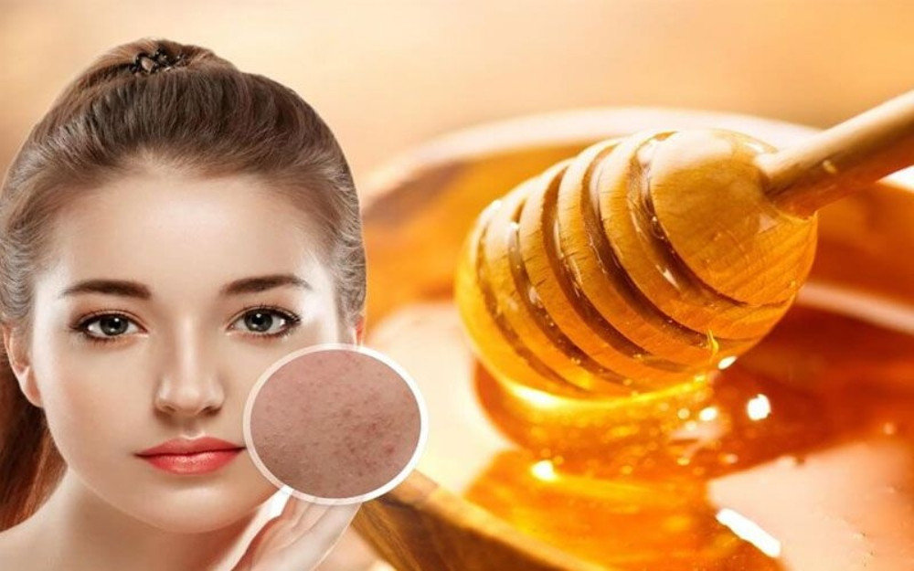 Cách Chăm Sóc Da Mụn Đầu Đen Hiệu Quả và Đơn Giản