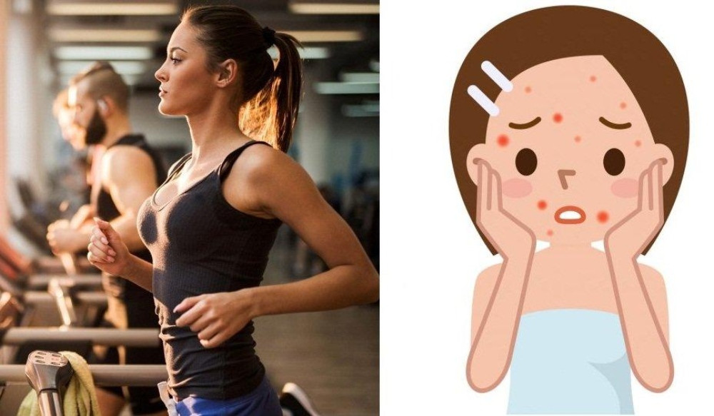 Cách Chăm Sóc Mụn Bọc Đúng Cách Để Tránh Tình Trạng Tái Phát