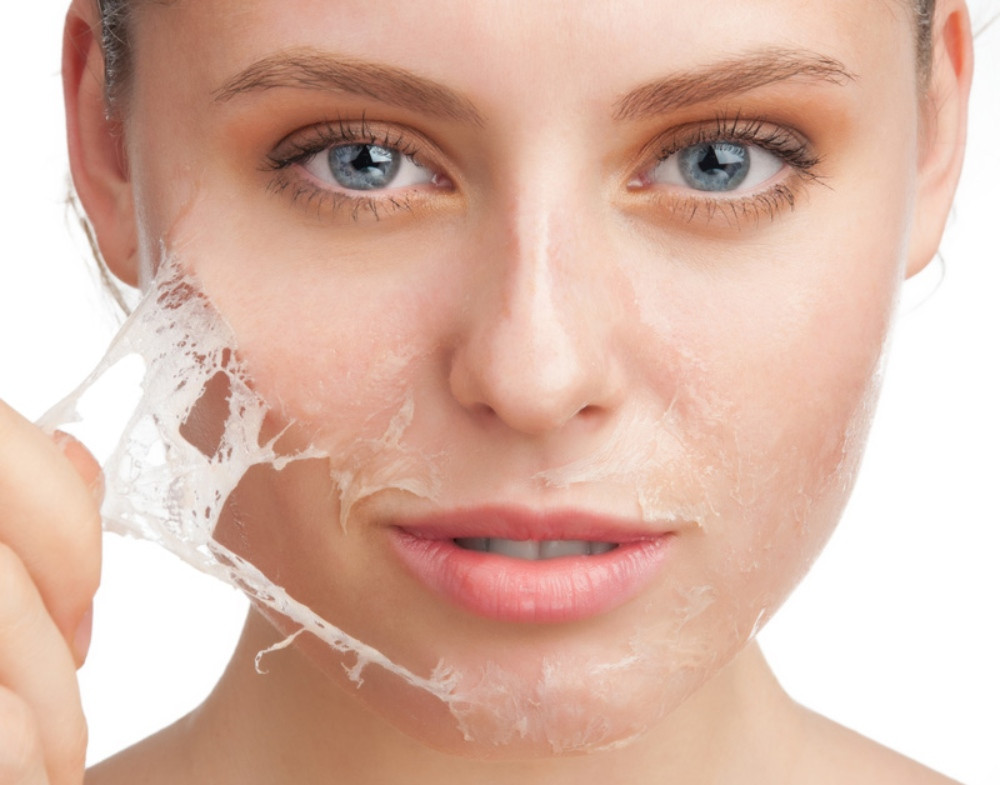 Cách Chăm Sóc Mụn Bọc Đúng Cách Để Tránh Tình Trạng Tái Phát