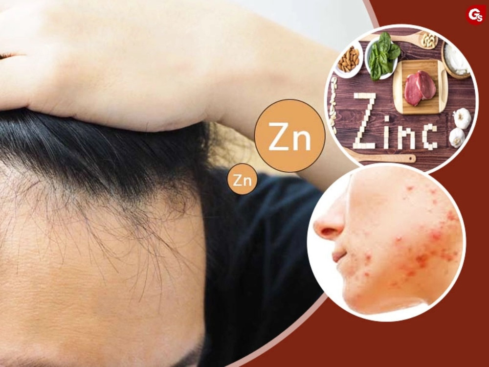 Cách Chăm Sóc Mụn Bọc Đúng Cách Để Tránh Tình Trạng Tái Phát