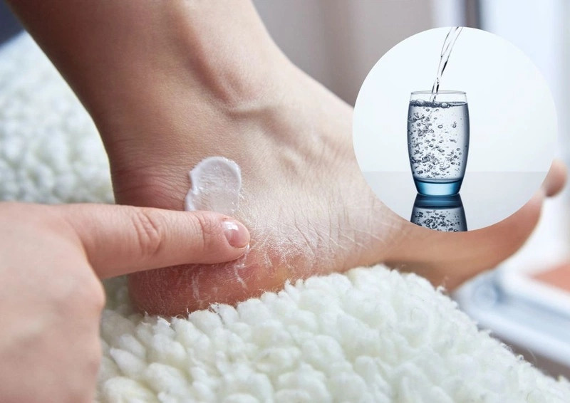 Cách Nhận Biết và Khắc Phục Tình Trạng Da Chân Bị Tróc Vảy Trắng