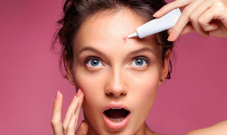 Cách Vệ Sinh Da Mặt Mụn Đúng Cách Để Da Khỏe Mạnh