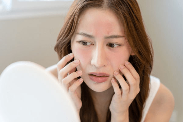 Da khô tróc vảy: Nguyên nhân và 10 cách khắc phục hiệu quả
